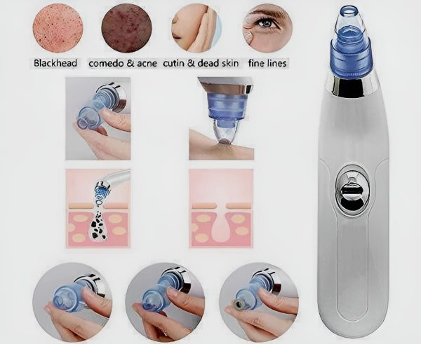 Derma Suction Blackheads Remover